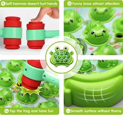 NEW HopeRock Whack A Frog Game Toddler Toy with 5 Modes 45 Levels Music & Lights